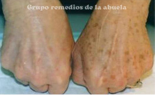 Acaba con las manchas y arrugas de la manos