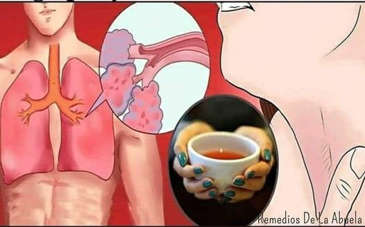 Remedio natural para eliminar el moco y la flema en la garganta