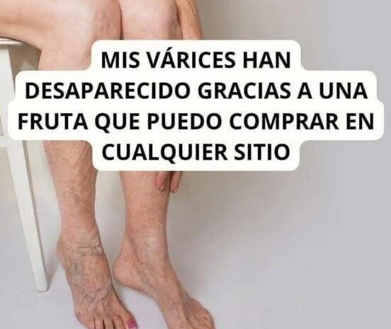 La Fruta Mágica que Reduce las Várices y Mejora Tu Salud