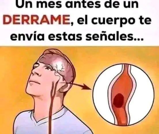 Señales Previas de un Derrame Cerebral: Cuidado con Tu Salud