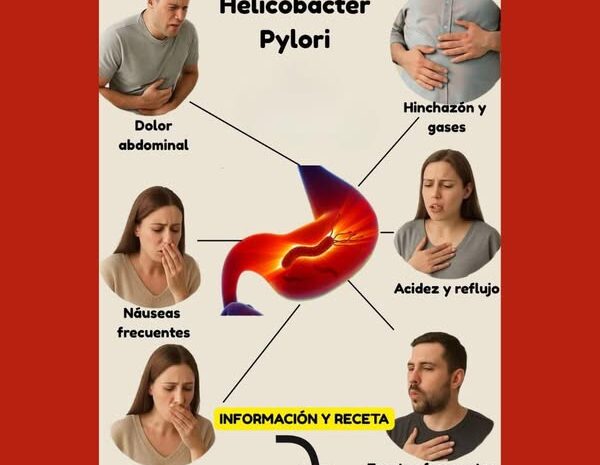 Síntomas del Helicobacter Pylori y Remedios Naturales para Aliviar sus Efectos