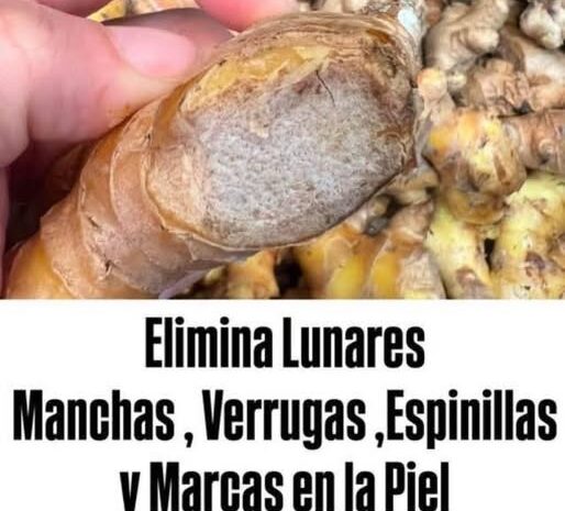 El Poder de la Cúrcuma: Un Tratamiento Casero Para Verrugas y Manchas en la Piel