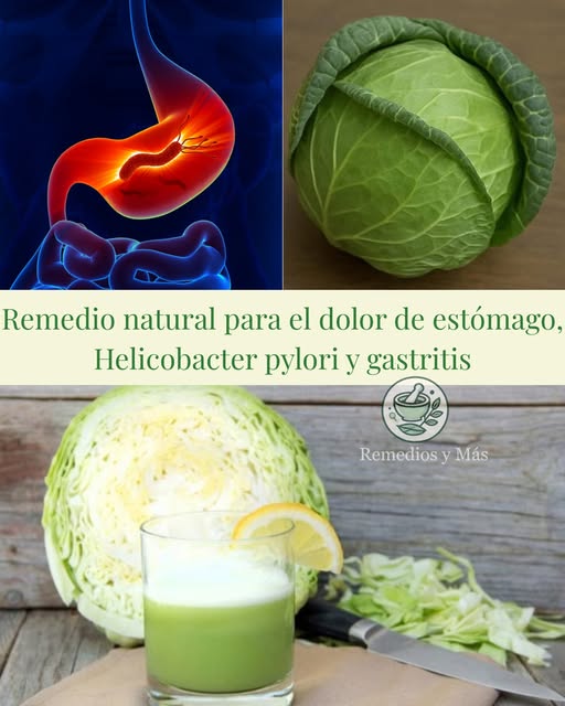 Remedio natural para el dolor de estómago, Helicobacter pylori y gastritis