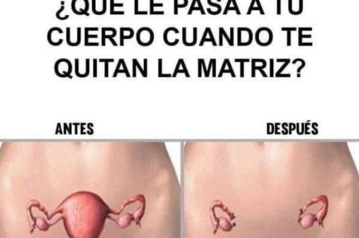 Impacto de la Histerectomía en el Cuerpo: ¿Qué Sucede tras la Extirpación del Útero?