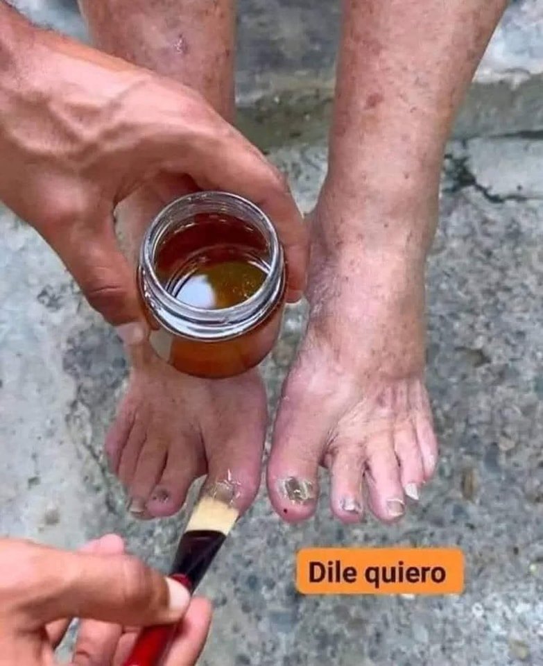Aplicación de Rompe Hongos
