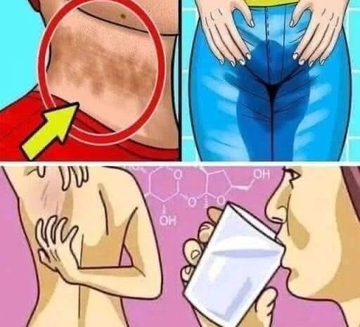 8 Señales de que Tienes Demasiado Azúcar en tu Dieta y Cómo Combatirlo