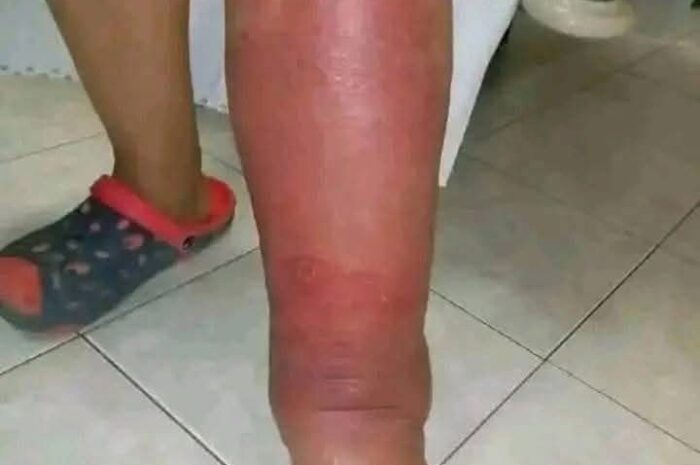 Identificando los Primeros Síntomas de Afecciones en la Piel