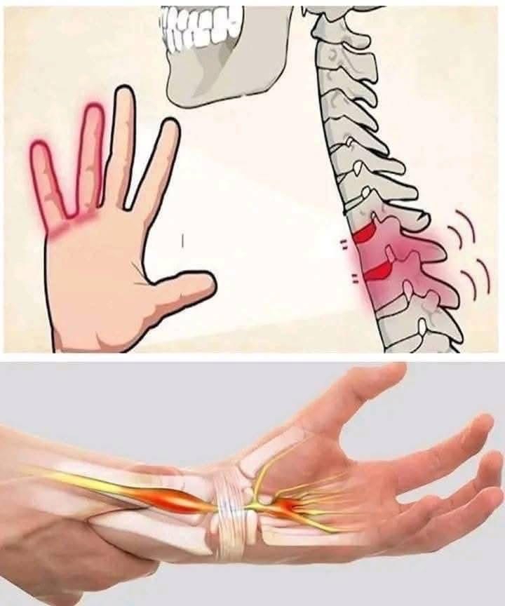 Columna cervical y manos