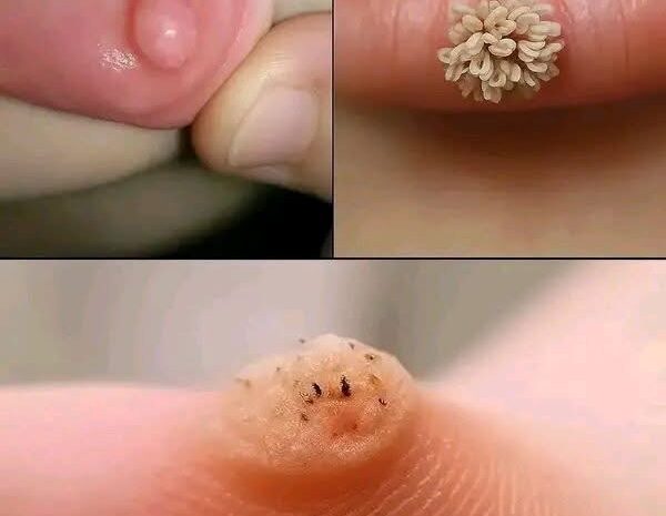 Primeros Signos de Afecciones Dermatológicas y Remedios Naturales