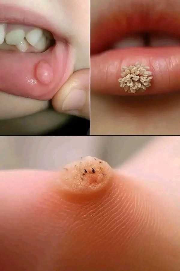 Problemas dermatológicos en labios y piel