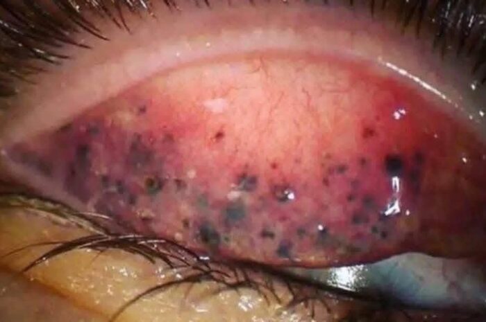 Consecuencias de Dormir con el Maquillaje: Cómo Cuidar tus Ojos