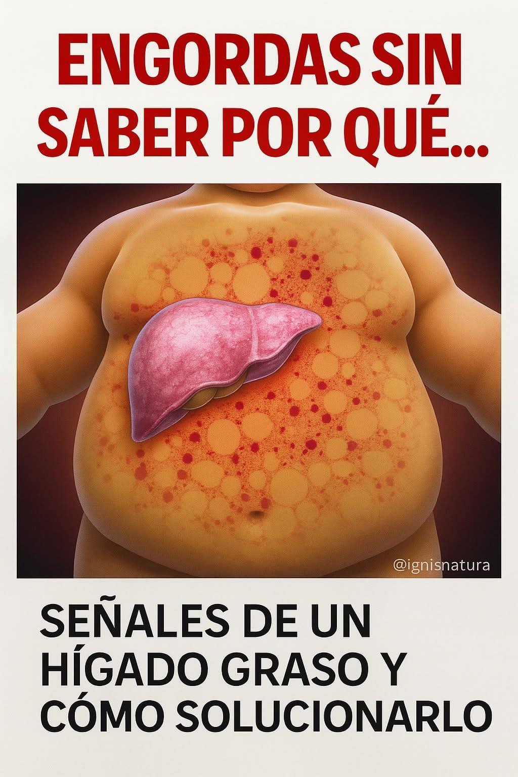 Señales de un hígado graso