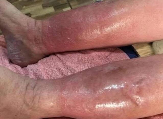 Signos Claros de Problemas de Salud en la Piel y Remedios Naturales