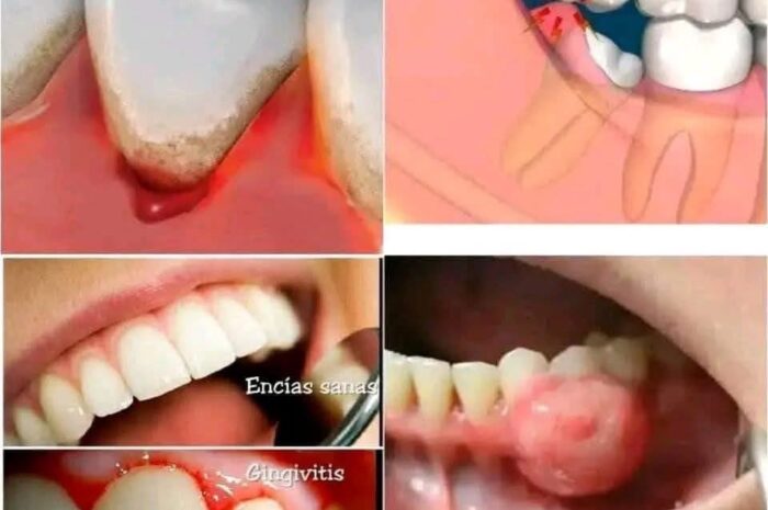 Signos Claros de Problemas Dentales: Cómo Identificarlos y Solucionarlos