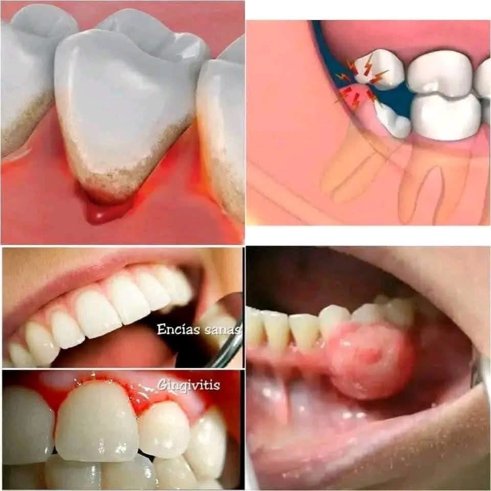 Ilustraciones de problemas dentales