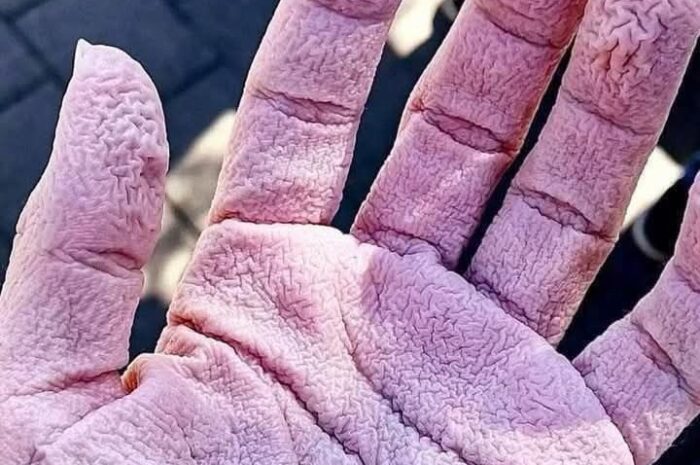 Señales del Cuerpo: Cómo Cuidar Tu Piel y Remedios Naturales