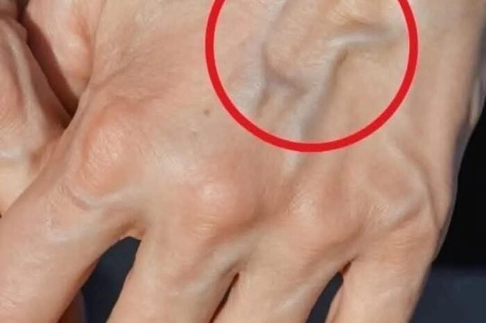 Venas Visibles: Causas y Remedios Naturales para Mejorar tu Salud Vascular