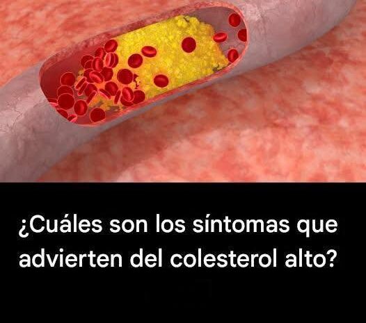 10 Síntomas de Colesterol Alto que Nunca Debes Ignorar
