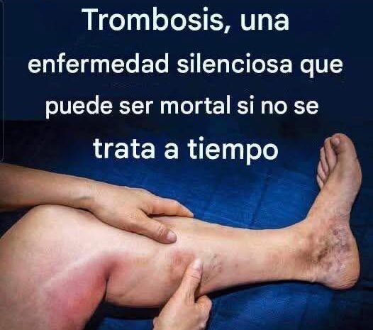 Las 6 Mejores Infusiones para Mantener Saludables Tus Arterias