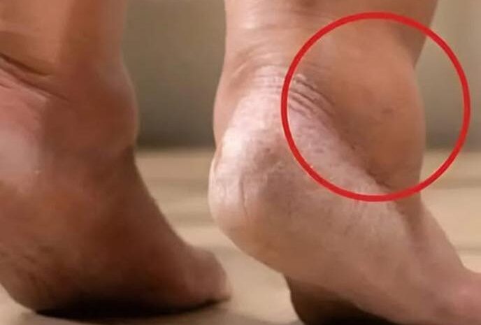 ¿Por qué se hinchan los pies? Causas y Remedios Naturales