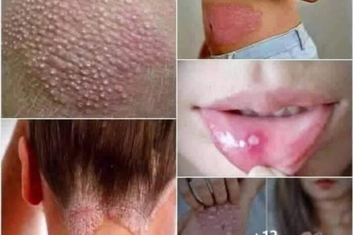 Señales de Problemas Dermatológicos: Lo Que Debes Saber