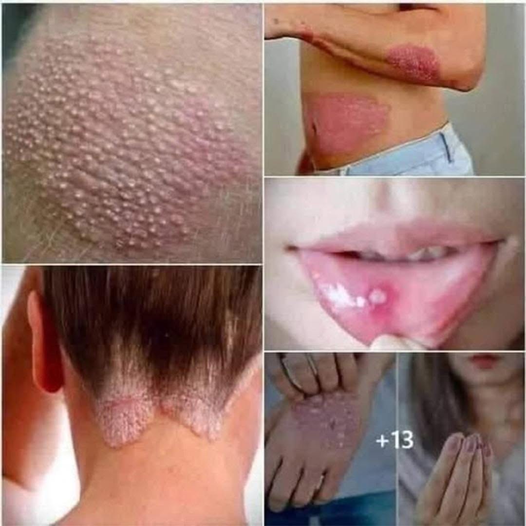 Condiciones de la piel