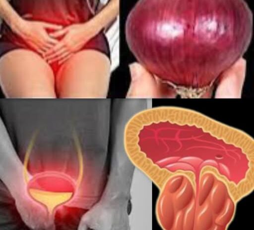 El Poder de la Cebolla: Un Remedio Natural para la Salud de la Próstata y la Vejiga