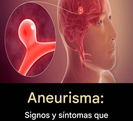Cómo Identificar los Primeros Signos y Síntomas de un Accidente Cerebrovascular