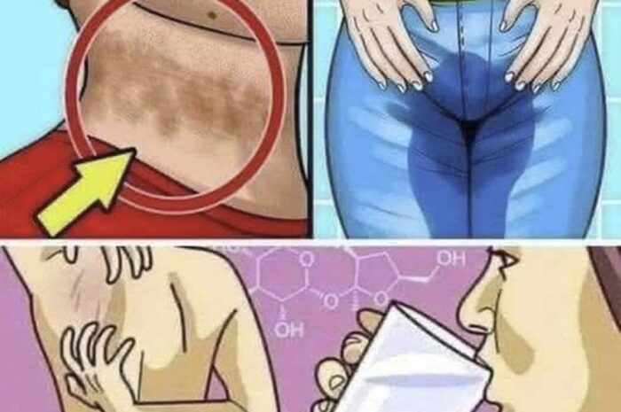 8 Señales de que Tienes Demasiado Azúcar en Tu Cuerpo y Cómo Aliviarlo