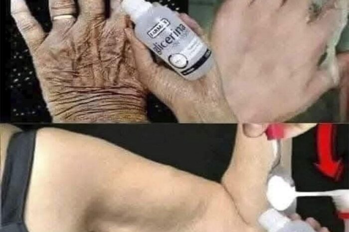 Rejuvenece tu Piel: Cómo la Glicerina Reduce Arrugas y Manchas