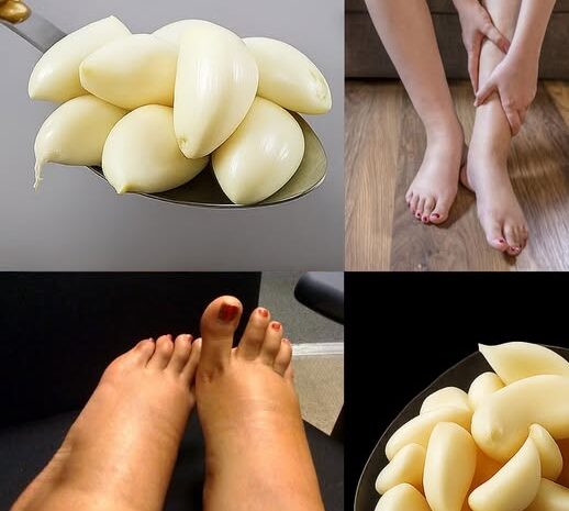 Remedio Natural: Mezcla de Ajo para Piernas Pesadas y Hinchazón