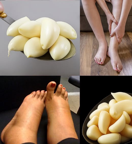 Imagen de Ajo y Piernas Hinchadas