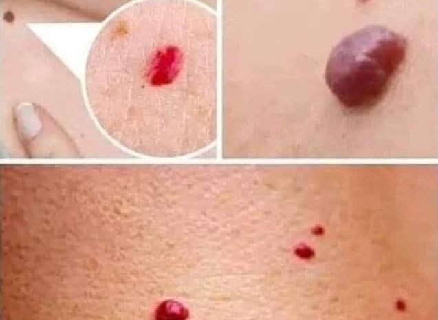 Descifrando los Puntos Rojos en la Piel: ¿Son Inofensivos o Debemos Preocuparnos?
