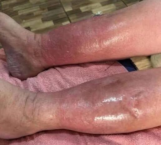Señales de Problemas en la Piel: Cuidados y Remedios Naturales
