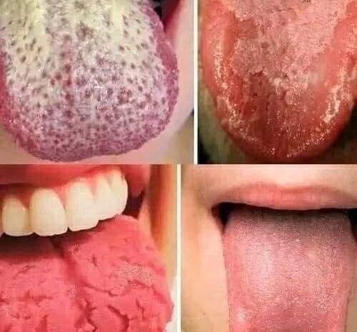 ¿Qué significa tener la lengua blanca? Causas, remedios y cuidados esenciales