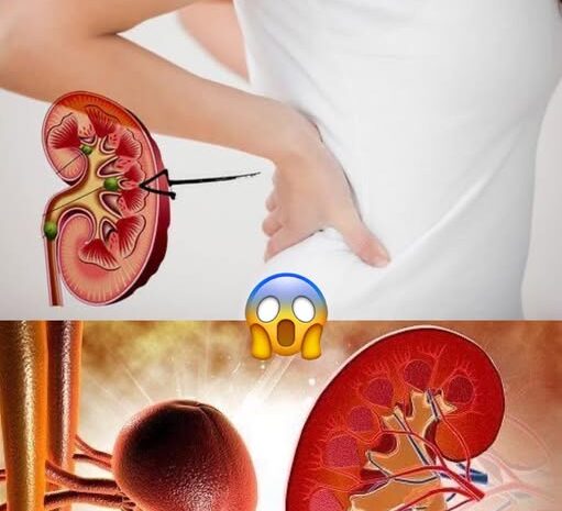 Limpia tu Sistema Renal: Remedios Naturales para una Salud Óptima