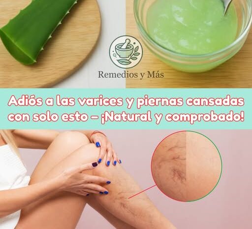 Dile Adiós a las Venas Varicosas y Piernas Pesadas con Aloe Vera: Un Remedio Natural Efectivo