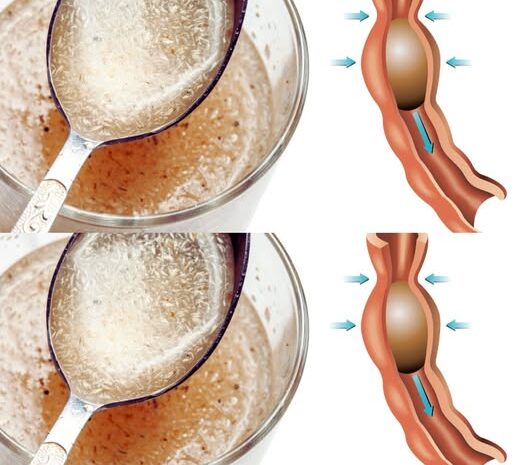 Descubre los Beneficios del Psyllium: Un Remedio Natural para la Salud Digestiva
