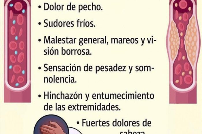 Identificando los Síntomas del Colesterol Alto y Cómo Mejorar Tu Salud