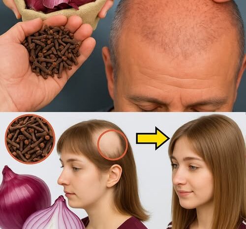 Remedios Naturales para el Crecimiento del Cabello: Cebolla y Clavos de Olor