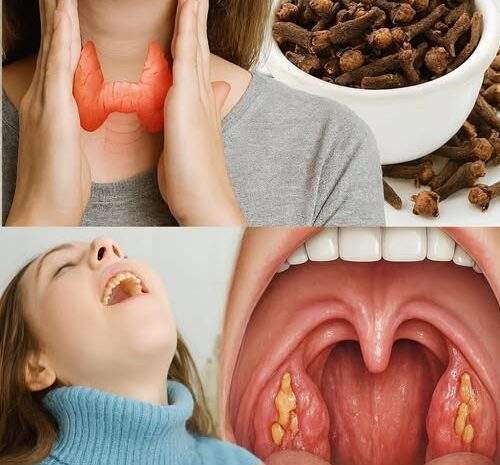 Clavos de Clavo: El Antibiótico Natural para el Dolor de Garganta