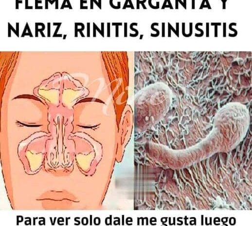 Elimina el Moco y la Flema: Remedios Caseros para Combatir la Rinitis y la Sinusitis