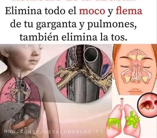 Remedio Natural para Eliminar Moco y Flema de los Pulmones