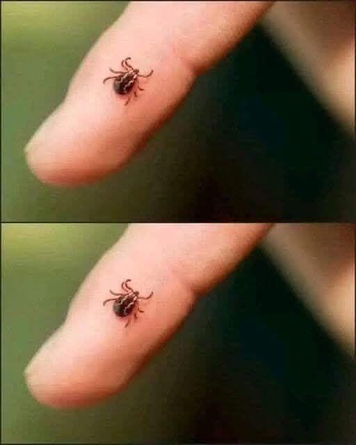Garrapata en dedo humano