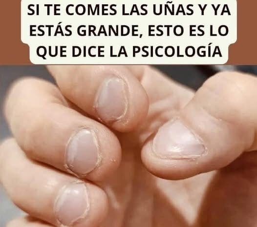 ¿Te Comes las Uñas? Descubre Qué Revela Este Hábito Según la Psicología