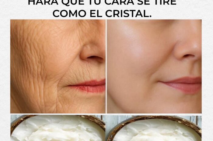 Crema de Bicarbonato: Adiós Arrugas y Manchas de Piel