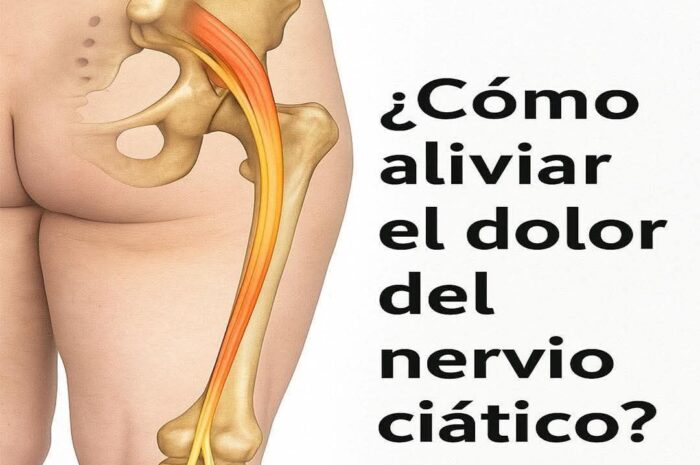 Alivio Natural del Dolor del Nervio Ciático: Remedios Caseros Efectivos