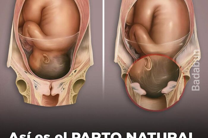 El Impacto del Parto Natural sin Anestesia: Una Experiencia Inolvidable