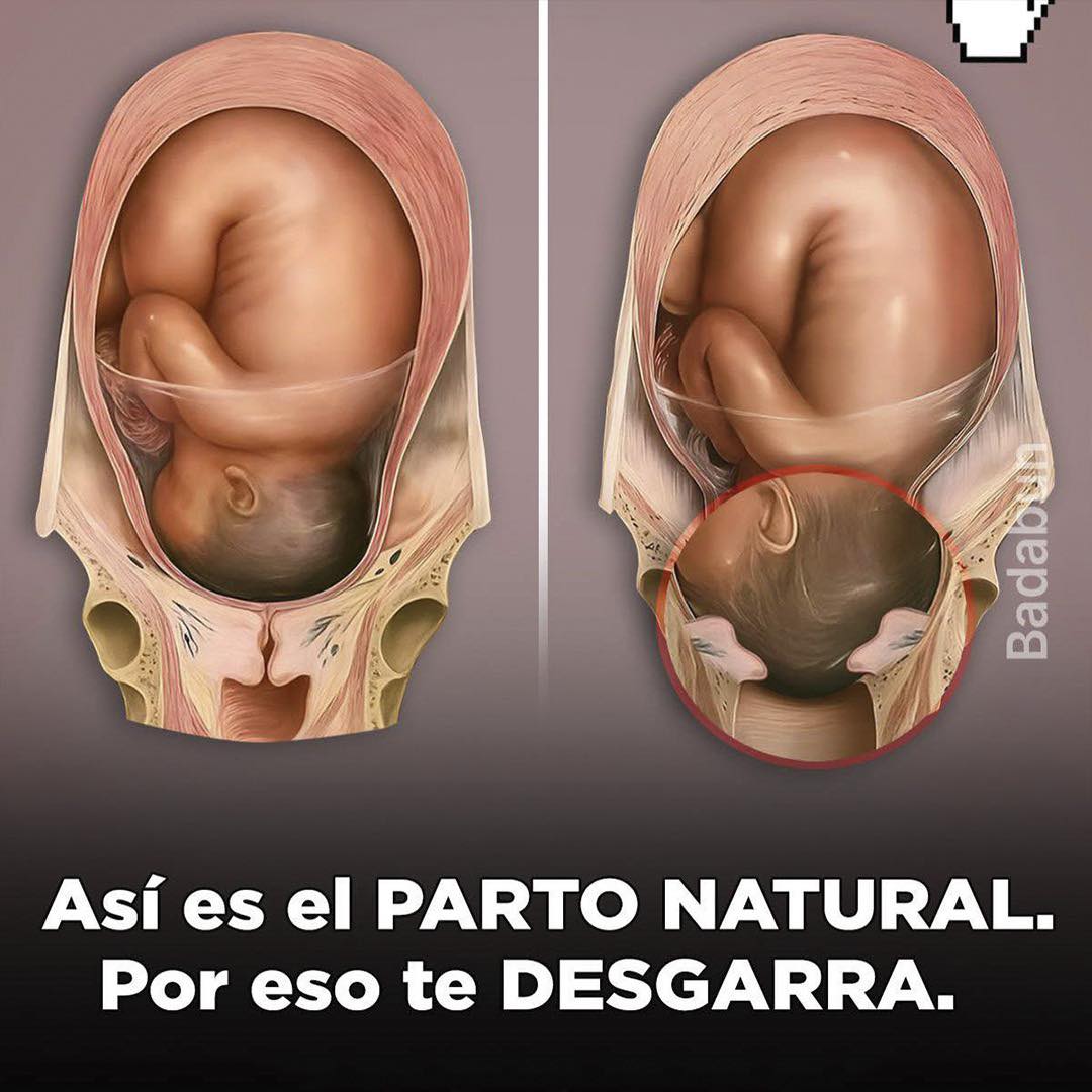Ilustraciones del proceso de un parto natural