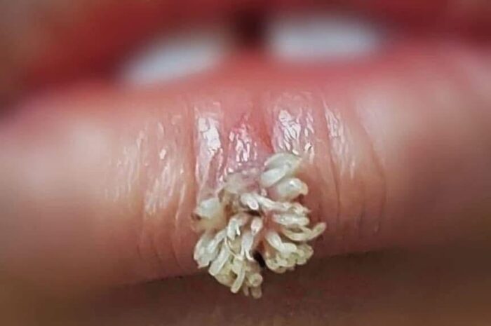 Remedios Naturales: Mejora Tu Salud Con Recetas Caseras